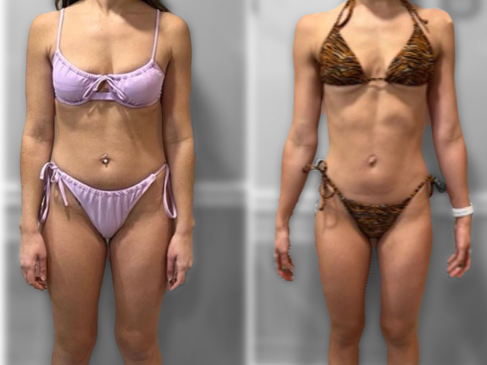 Sam - Before & After
